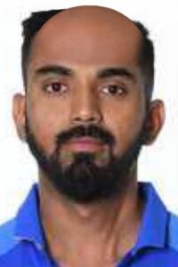 Indian Famous Cricketer If They Go Bald